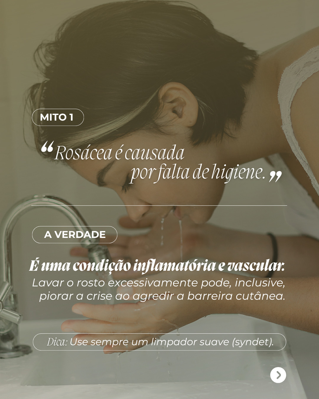 Rosacea2