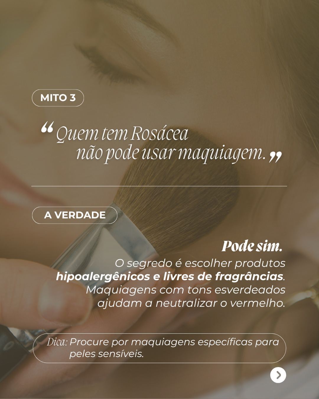 Rosacea4