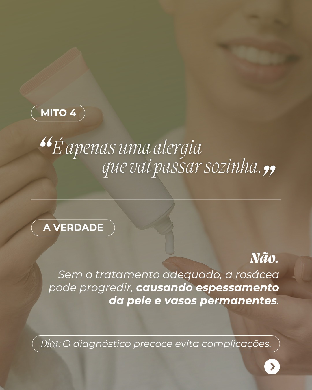 Rosacea5