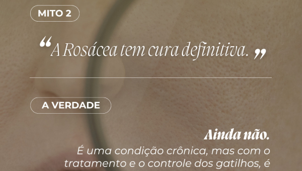 Rosacea3 Thumbnail